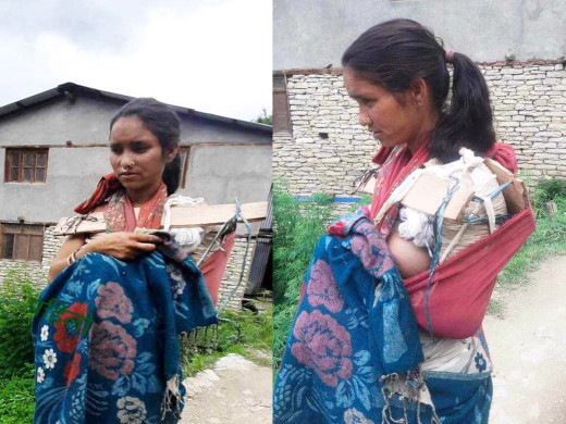 हाँत भाँचिदा काठले अड्याएकी नानीले उपचार पाइन्